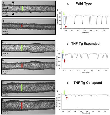 Ex vivo Demonstration of Functional Deficiencies in Popliteal Lymphatic Vessels From TNF-Transgenic Mice With Inflammatory Arthritis